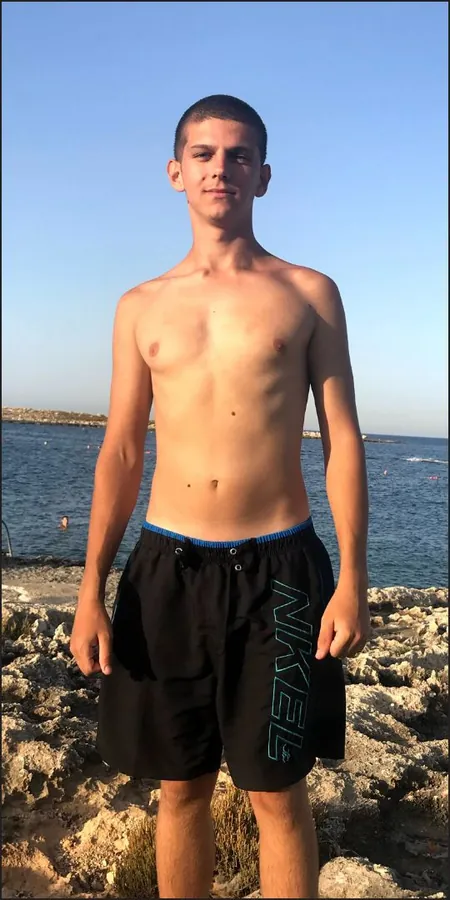 Muscle, before
